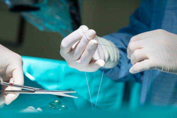 Doctor doing surgical stitches